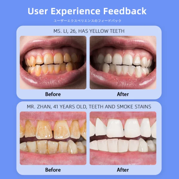 Dr.ville Original Teeth Whitening Toothpaste Remove Tooth Stains Niacinamide Toothpaste - Image 2