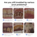 Dr.ville Original Teeth Whitening Toothpaste Remove Tooth Stains Niacinamide Toothpaste