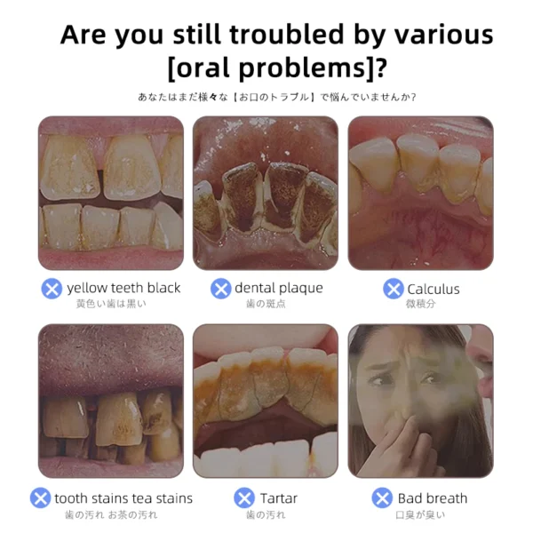 Dr.ville Original Teeth Whitening Toothpaste Remove Tooth Stains Niacinamide Toothpaste - Image 4